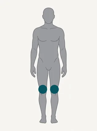 Body diagram with the knees highlighted